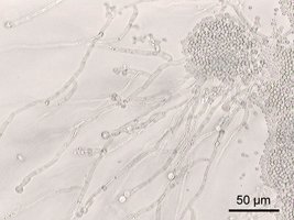 Candida Albicans At 200X Magnification.