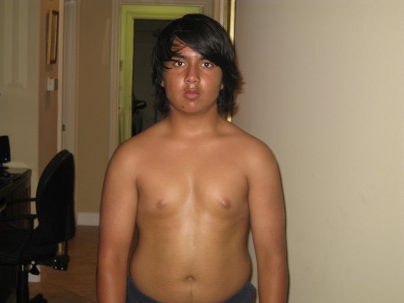Pictures Of Fat Teenagers 118