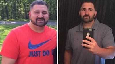 Patrick Lost Nearly 70 Pounds In Hopes Of Healing His Back