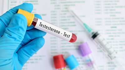 Are Testosterone Boosters Safe?