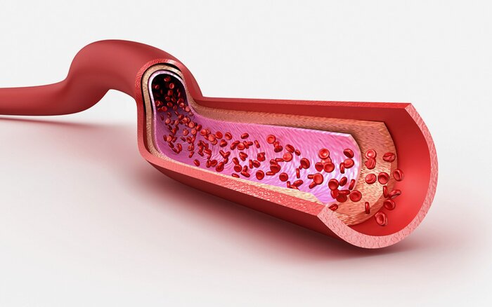 Image of blood vessels