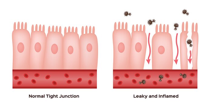 Leaky gut